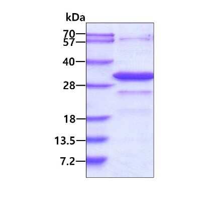 SDS-PAGE: Recombinant Human HIF-1 alpha His Protein [NBP1-45300]